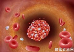 麦卢卡蜂蜜的功效之巧溶血栓经验分享